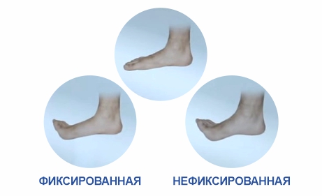 Ортопедические стельки своими руками: пошаговая инструкция на ремонты-бмв.рф